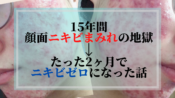 ニュースキンは本当にニキビに効く 何がやばいかぶっちゃけます 15年苦しみ続けたニキビを2ヶ月で根絶した 元 顔面ぶつぶつアラサー女の人生逆転物語